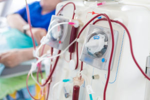 What Happens if You Miss Kidney Dialysis? The Importance of Reliable Transportation