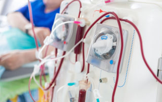 What Happens if You Miss Kidney Dialysis? The Importance of Reliable Transportation
